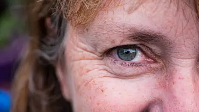 Golden Eye: Nowoczesna metoda na cienie i zmarszczki wokół oczu